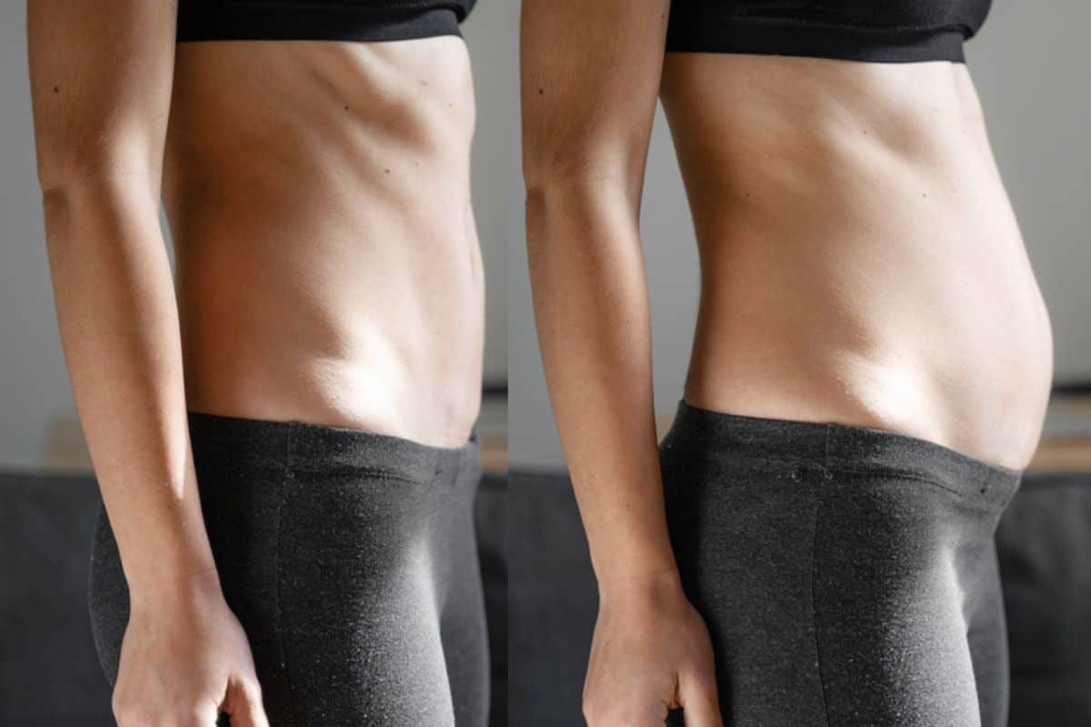 How long does diastasis recti take to improve Bexhill?