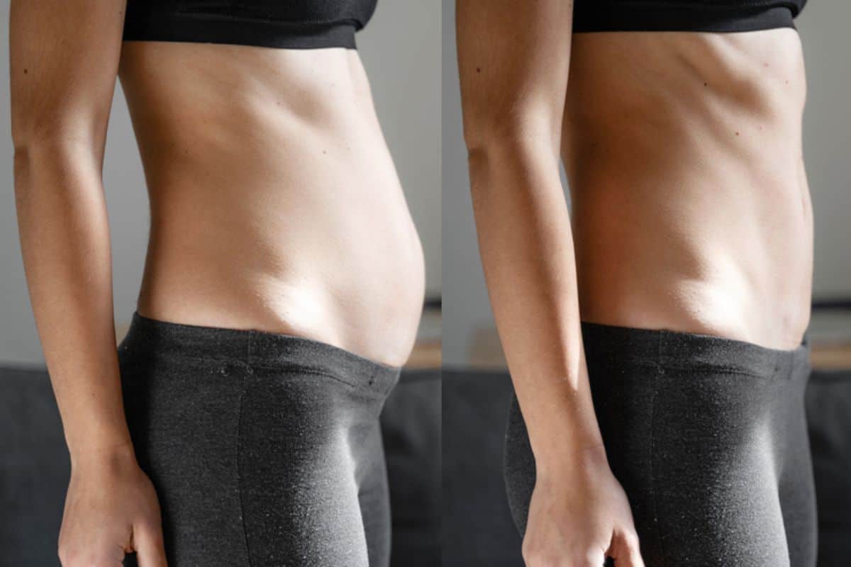 Post-Pregnancy: What Happens to Your Abdominal Muscles After Birth Bexhill
