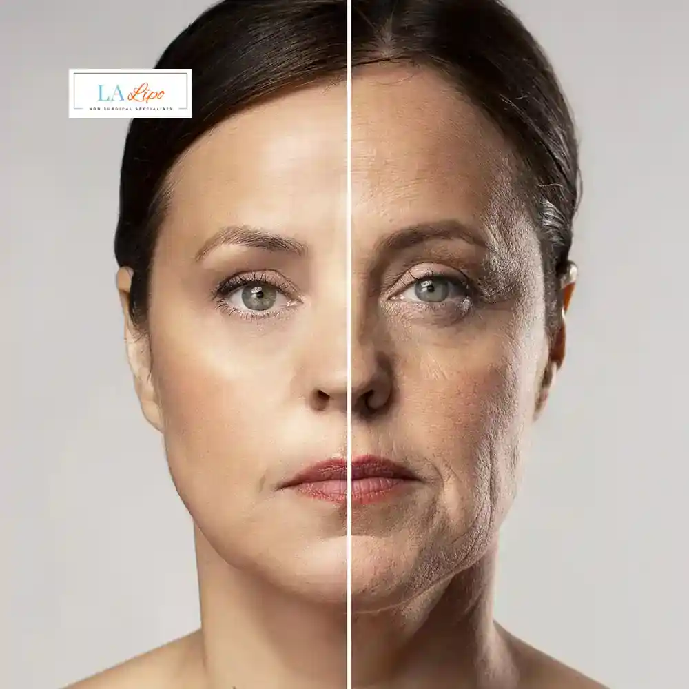 How Can You Tell If Non-Surgical Skin Tightening Is Right for You Bexhill?