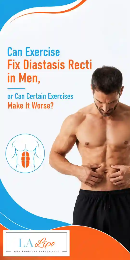 Can Exercise Fix Diastasis Recti in Men, or Can Certain Exercises Make It Worse Bexhill?